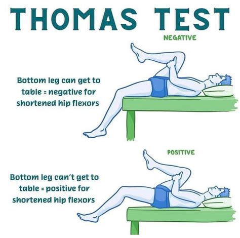 thomas test for tight flexors